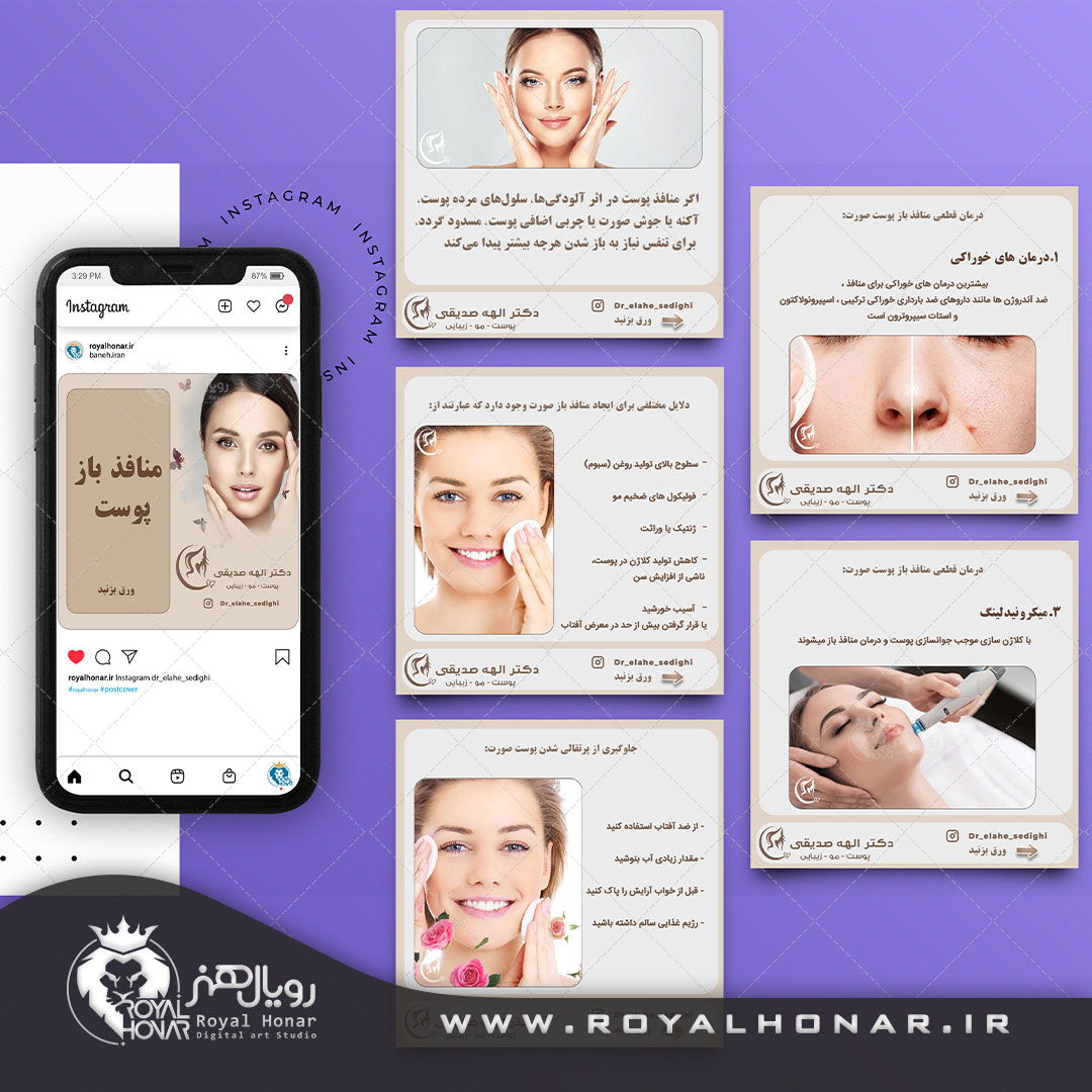 طراحی کاور پست و استوری